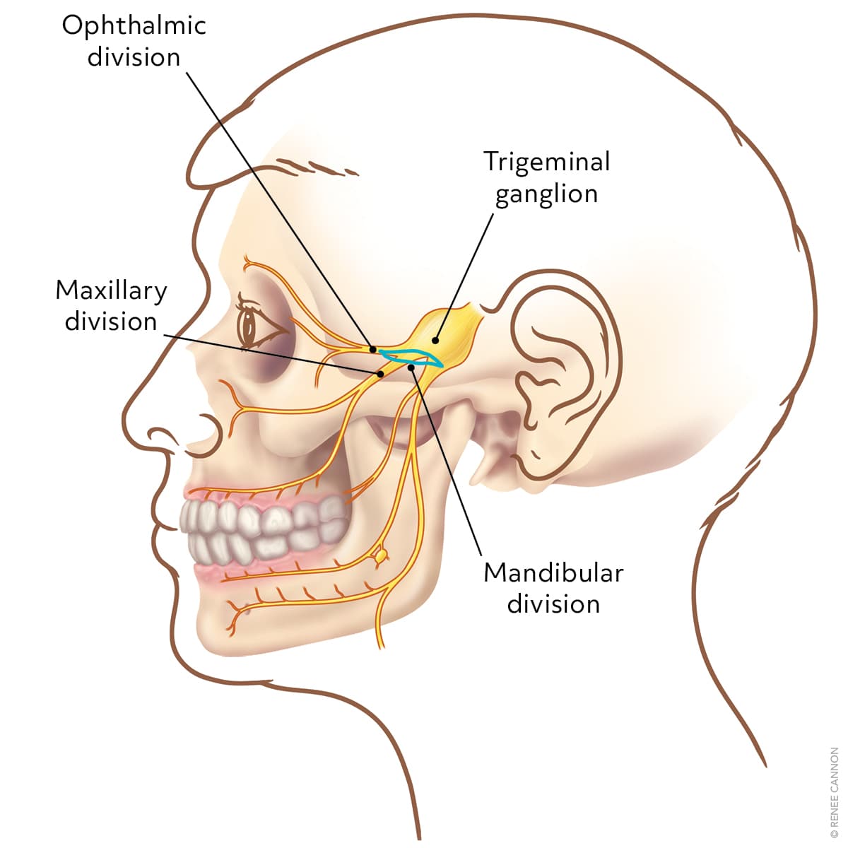Trigeminal Neuralgia: Rapid Evidence Review | AFP