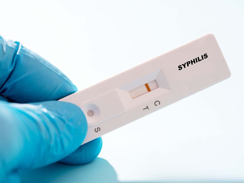 Screen Higher-risk Patients for Syphilis, Task Force Advises | AAFP