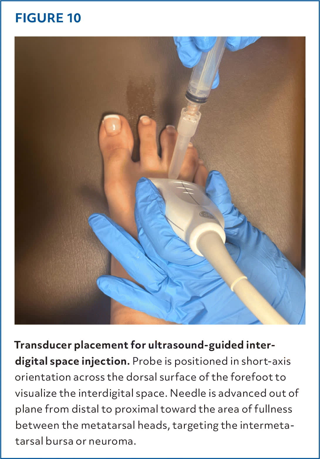 Injections of the Foot and Ankle | AFP