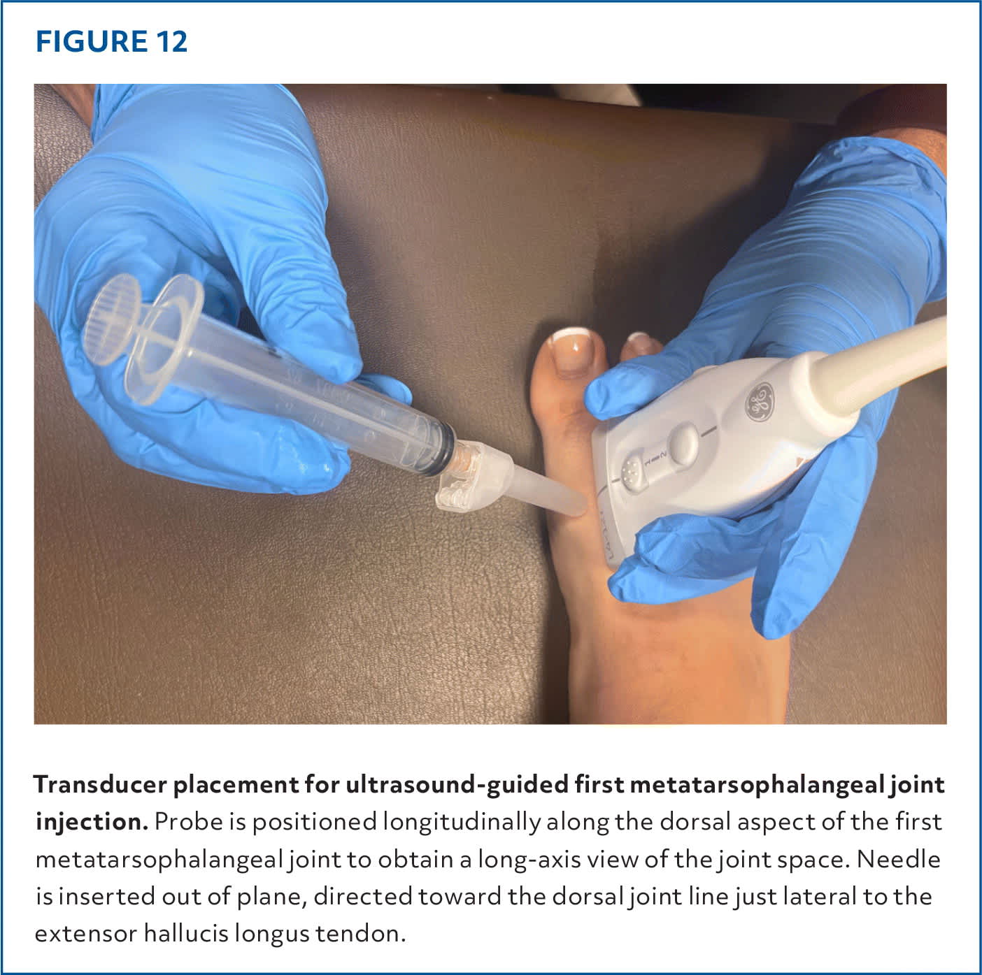 Injections of the Foot and Ankle | AFP
