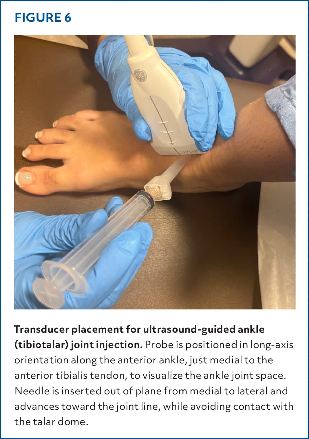Injections of the Foot and Ankle | AFP