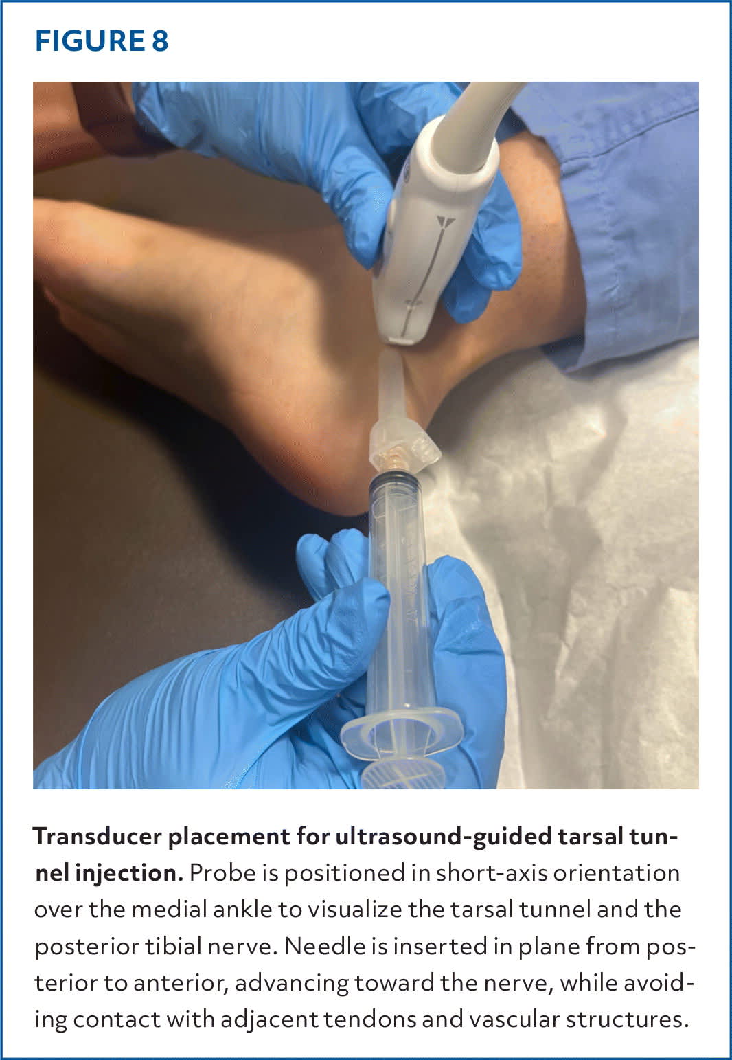 Injections of the Foot and Ankle | AFP