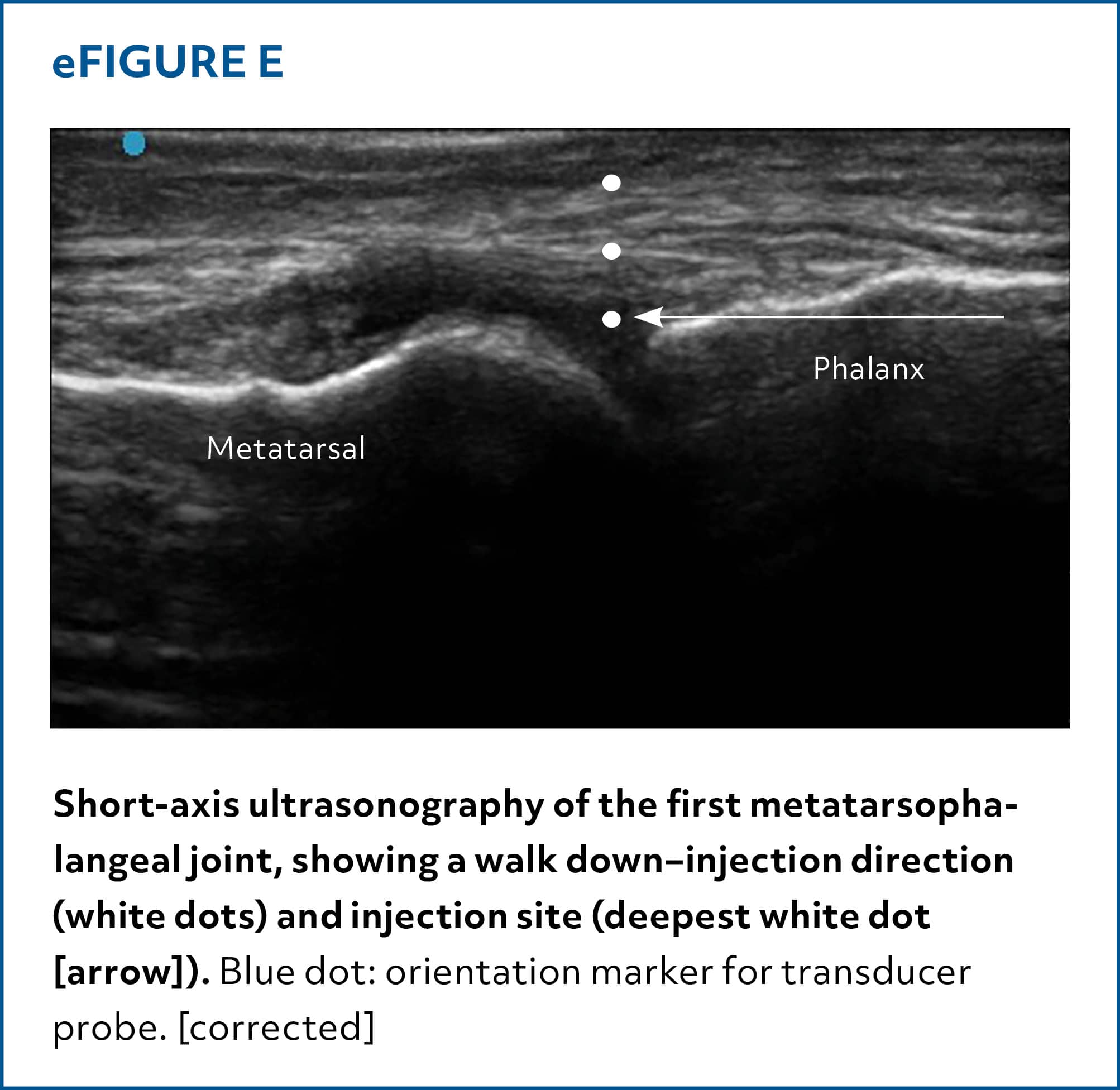 Injections of the Foot and Ankle | AFP