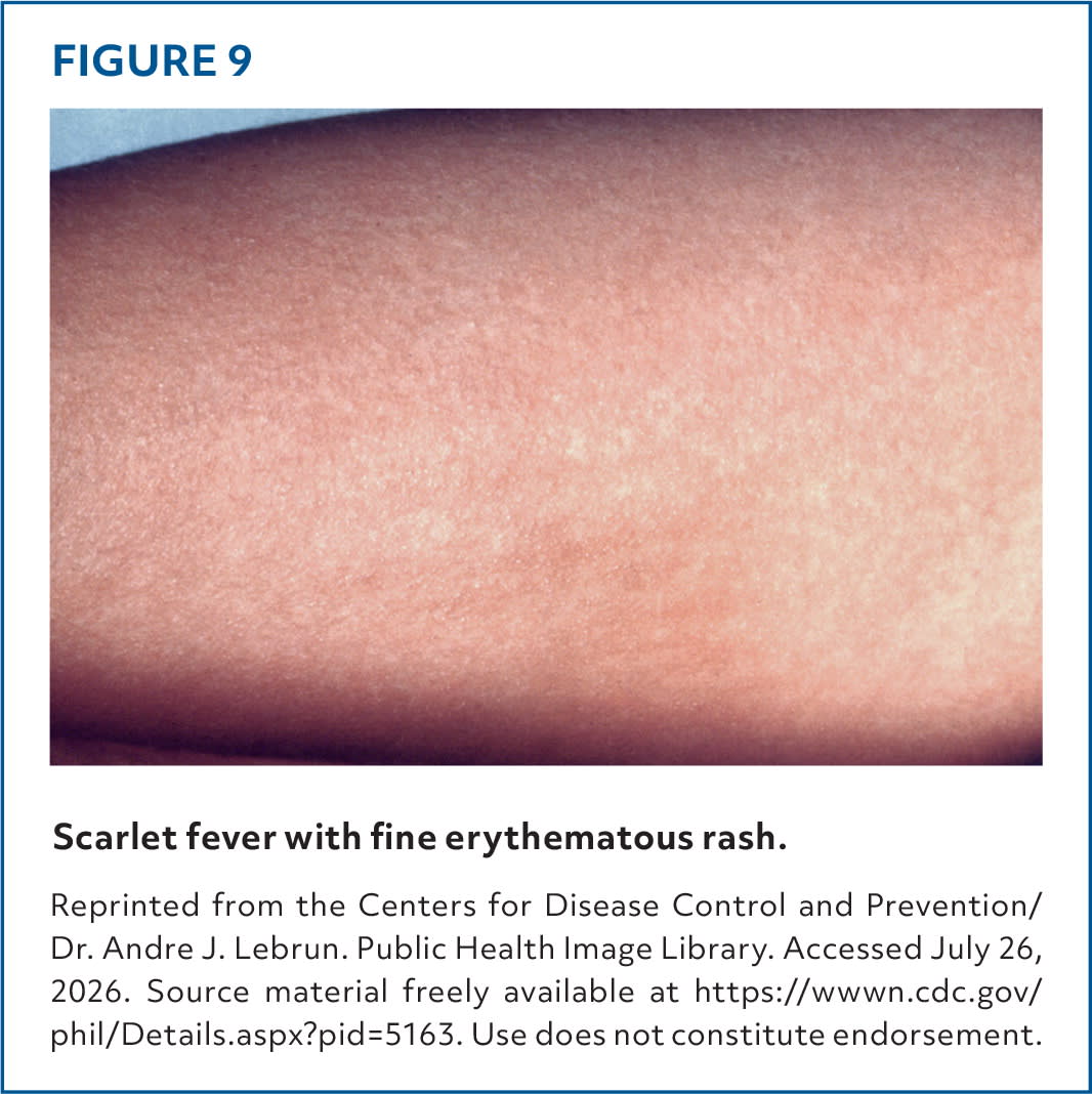Common Skin Rashes in Children | AFP